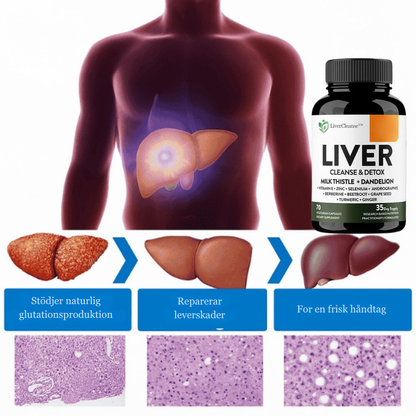 LiverCleanse™ | Giv din krop en ny start og rense leveren naturligt