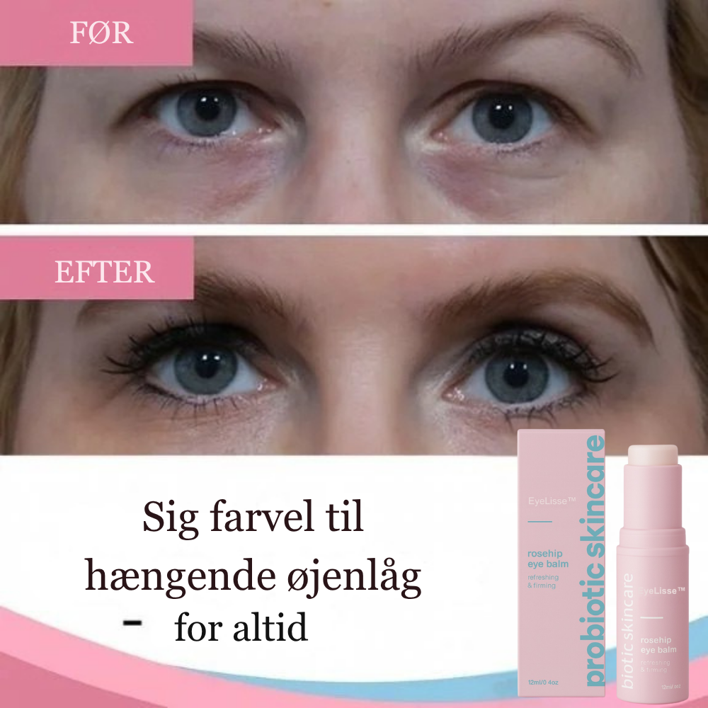 EyeLisse™ | Væk trætte øjne til live med beroligende næring og naturlig glød