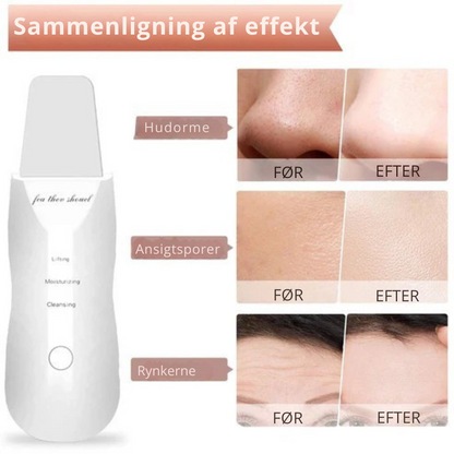 DermaPure™ | Ultralydsskrubber til huden