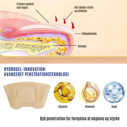 NailRepair™ | Plaster til neglesvamp