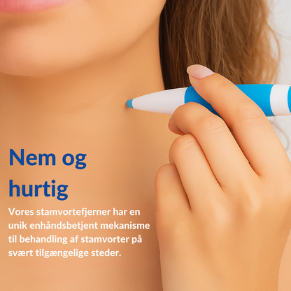 TagErase™ | Sig farvel til stamvorter