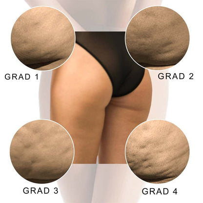 CelluRoller™ | Skulpter, udglatter og opstrammer med hver rulle