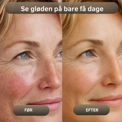 NaturaBalm™ | Den naturlige fugt, din hud har længtes efter