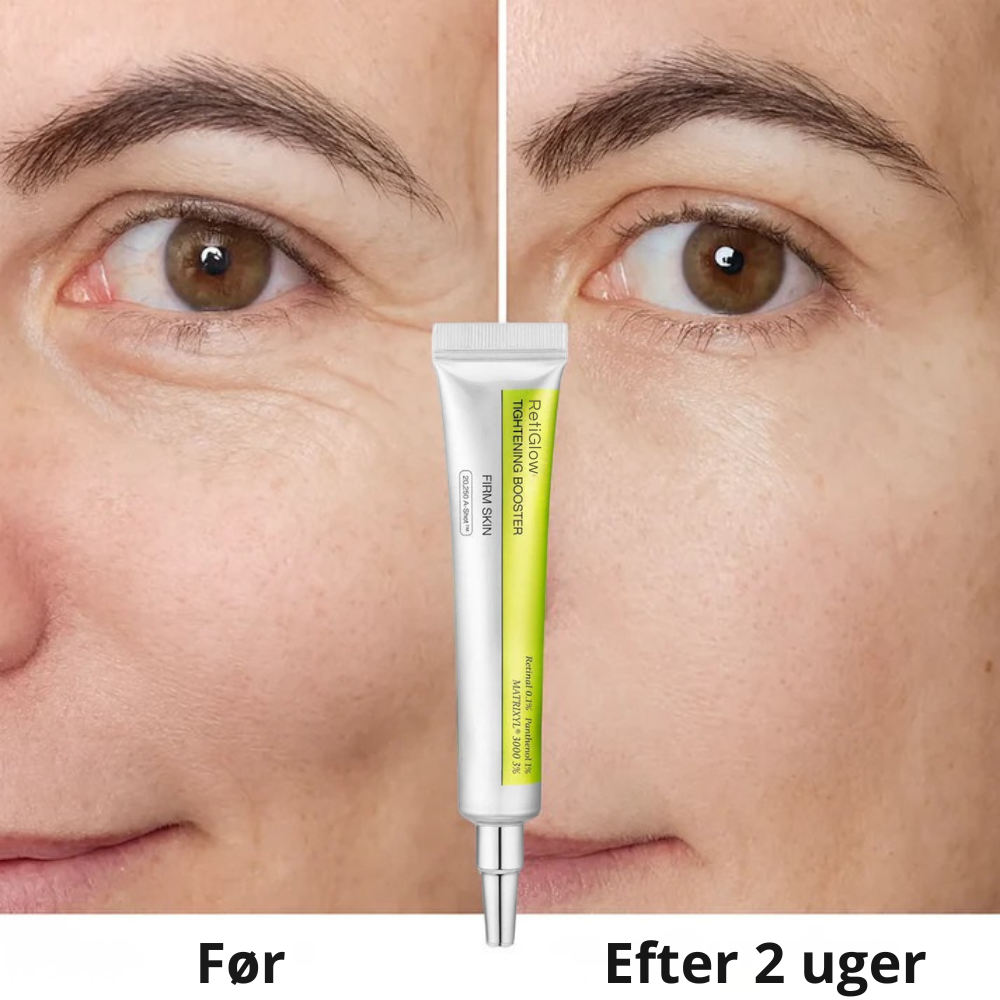 RetiGlow™ | Genskab din naturlige glød og få ungdommelige øjne igen
