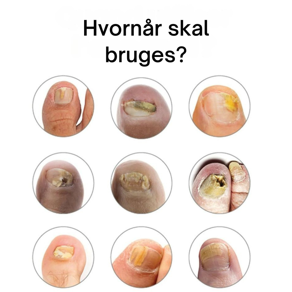 NailCure™ | Ultimativ neglebehandling til sunde, smukke negle