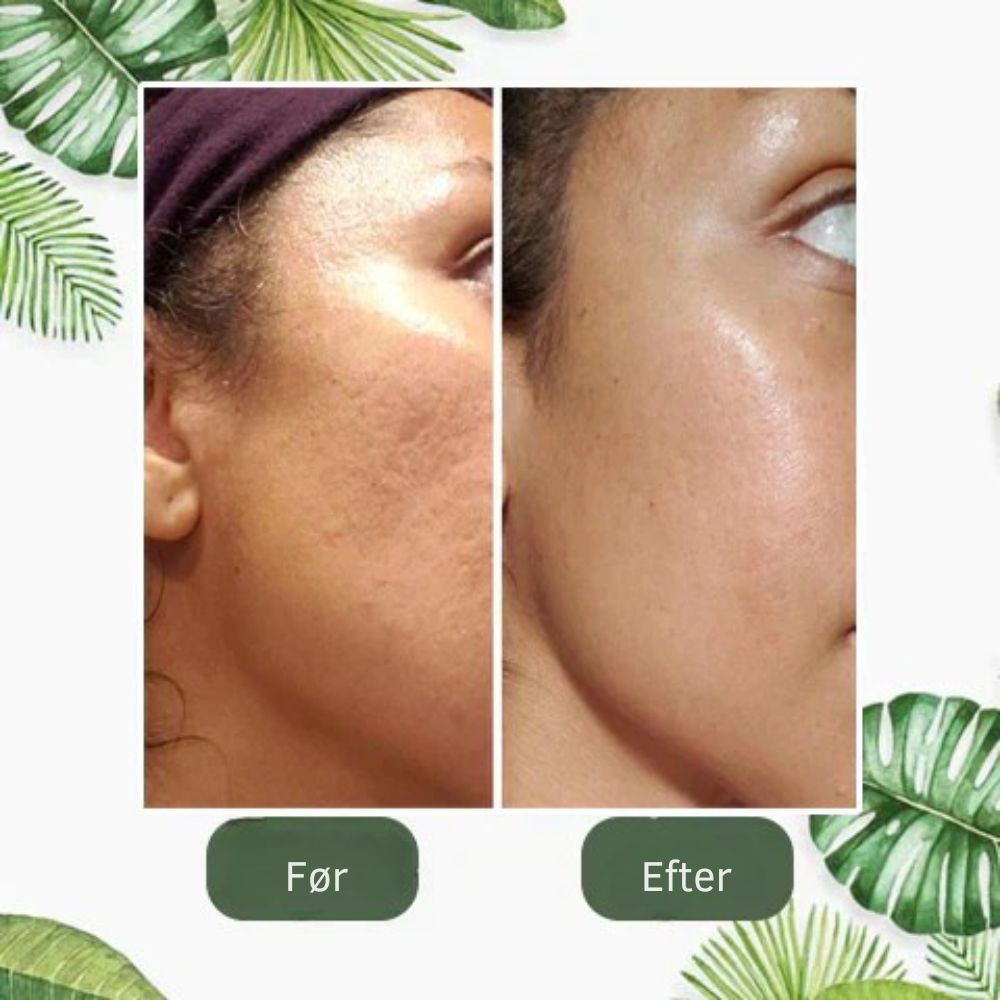 SkinRenew™ | Grøn te maske-stick – genopfrisk huden og få et yngre look