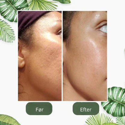 SkinRenew™ | Grøn te maske-stick – genopfrisk huden og få et yngre look