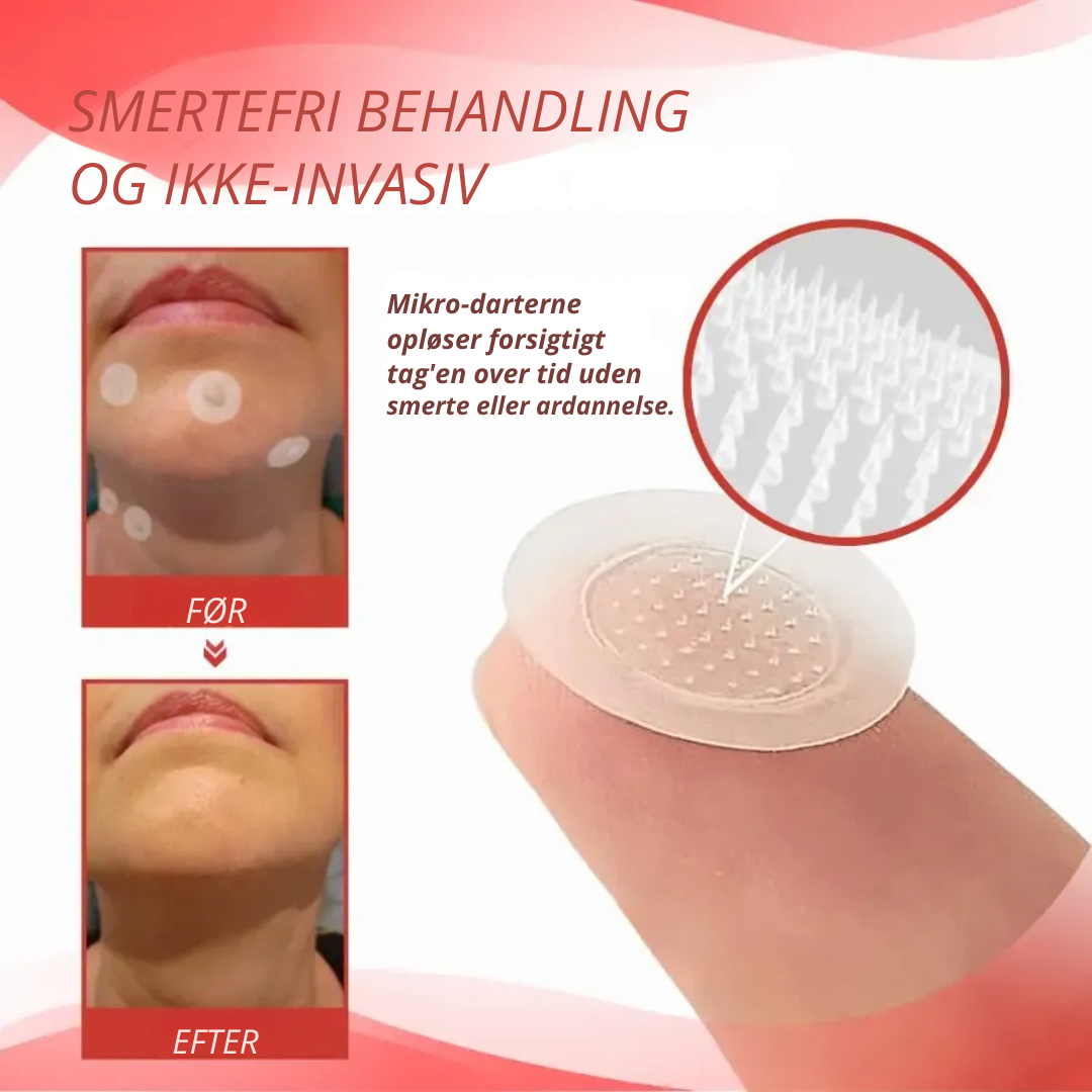 DermaPatch™ | Fjern hængende vorter smertefrit – uden ar, uden snit, uden stress!