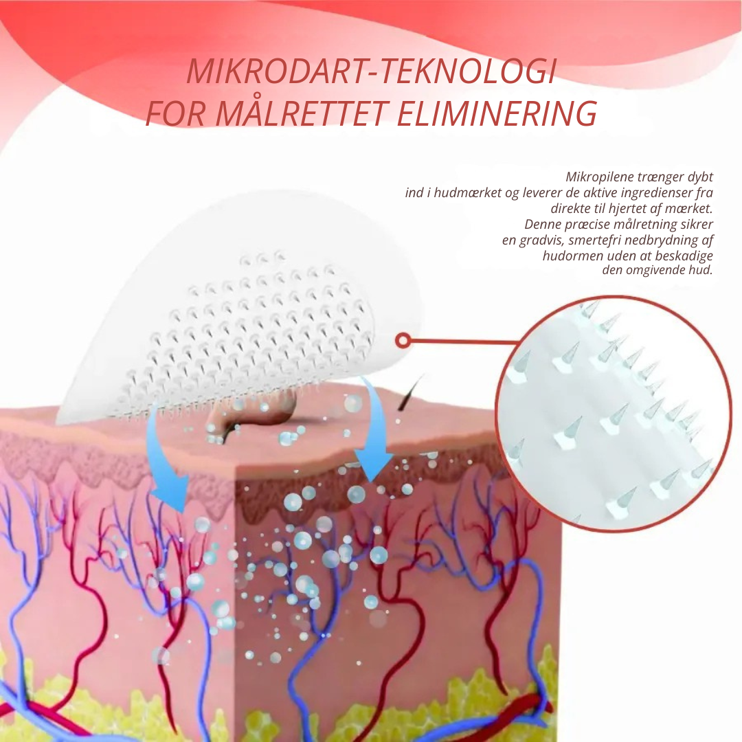 DermaPatch™ | Fjern hængende vorter smertefrit – uden ar, uden snit, uden stress!