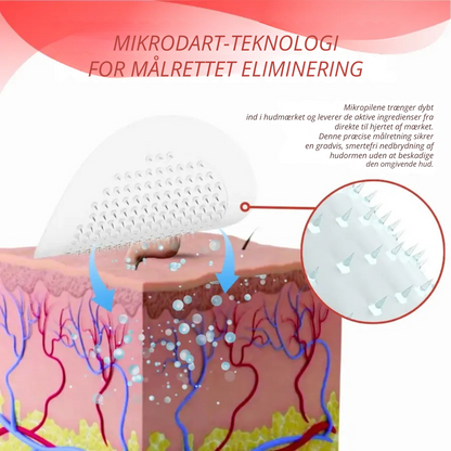 DermaPatch™ | Fjern hængende vorter smertefrit – uden ar, uden snit, uden stress!