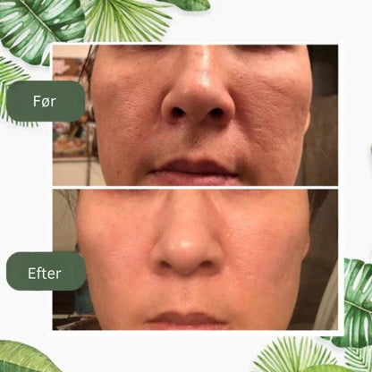 SkinRenew™ | Grøn te maske-stick – genopfrisk huden og få et yngre look