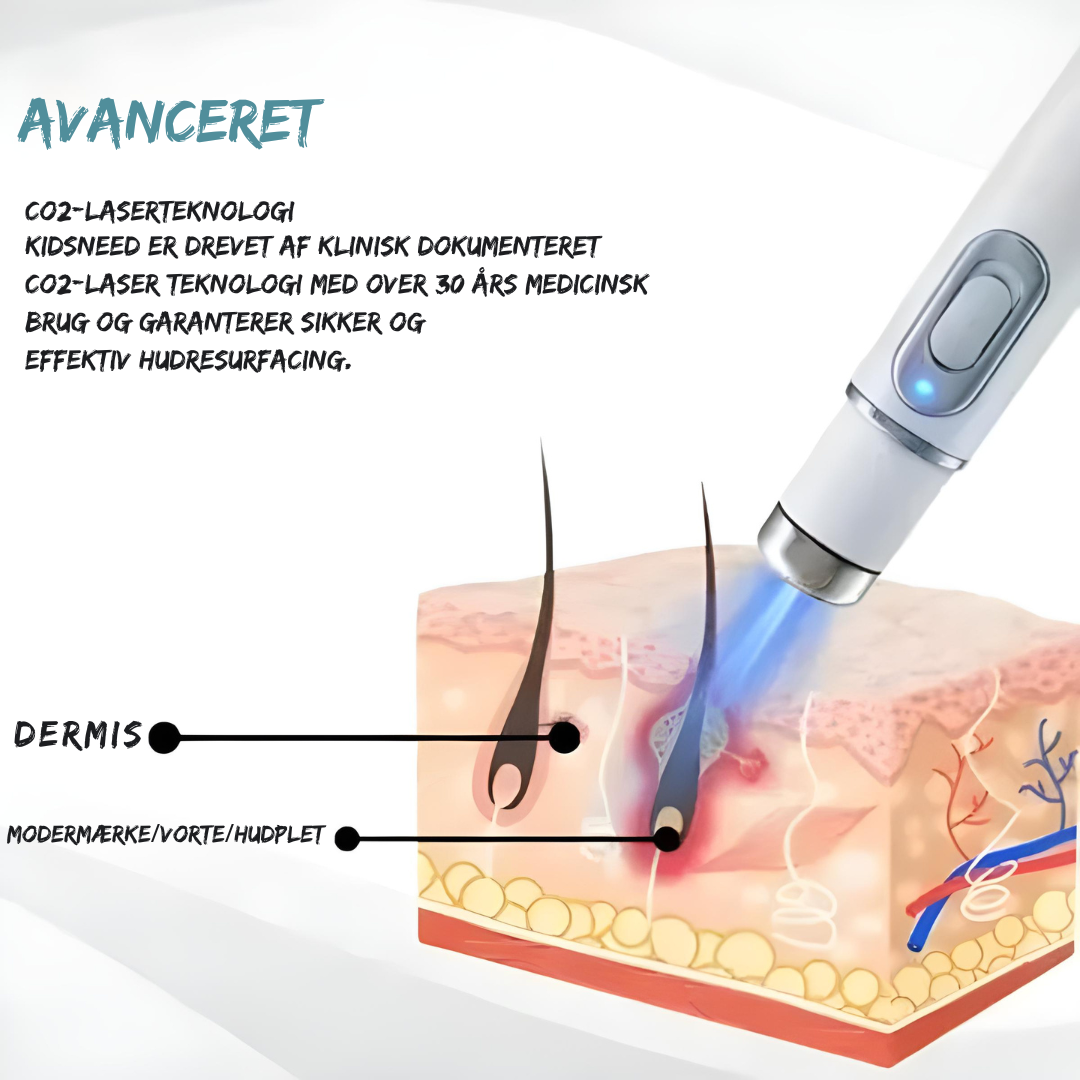 SilkLaser™ | Præcision og blødhed i ét