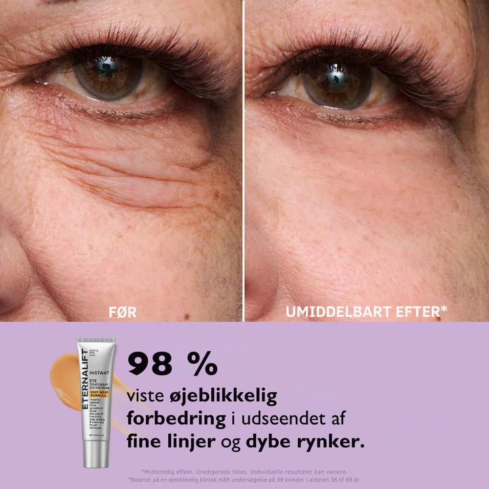 EternaLift™ | Øjencremen der fjerner poser under øjnene øjeblikkeligt og får dig til at se 10 år yngre ud