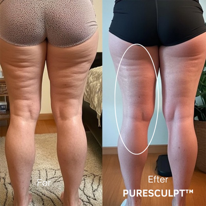 PureSculpt™ | Opstram, udglat og forny din hud – naturligt og effektivt