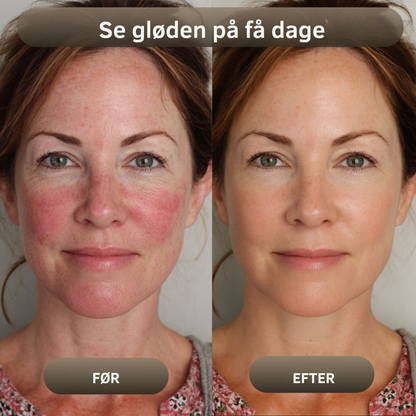 NaturaBalm™ | Den naturlige fugt, din hud har længtes efter