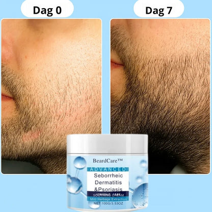 BeardCare™ | Premium skægplejesæt – Stop kløe og irritation, og få et sundt, velplejet skæg