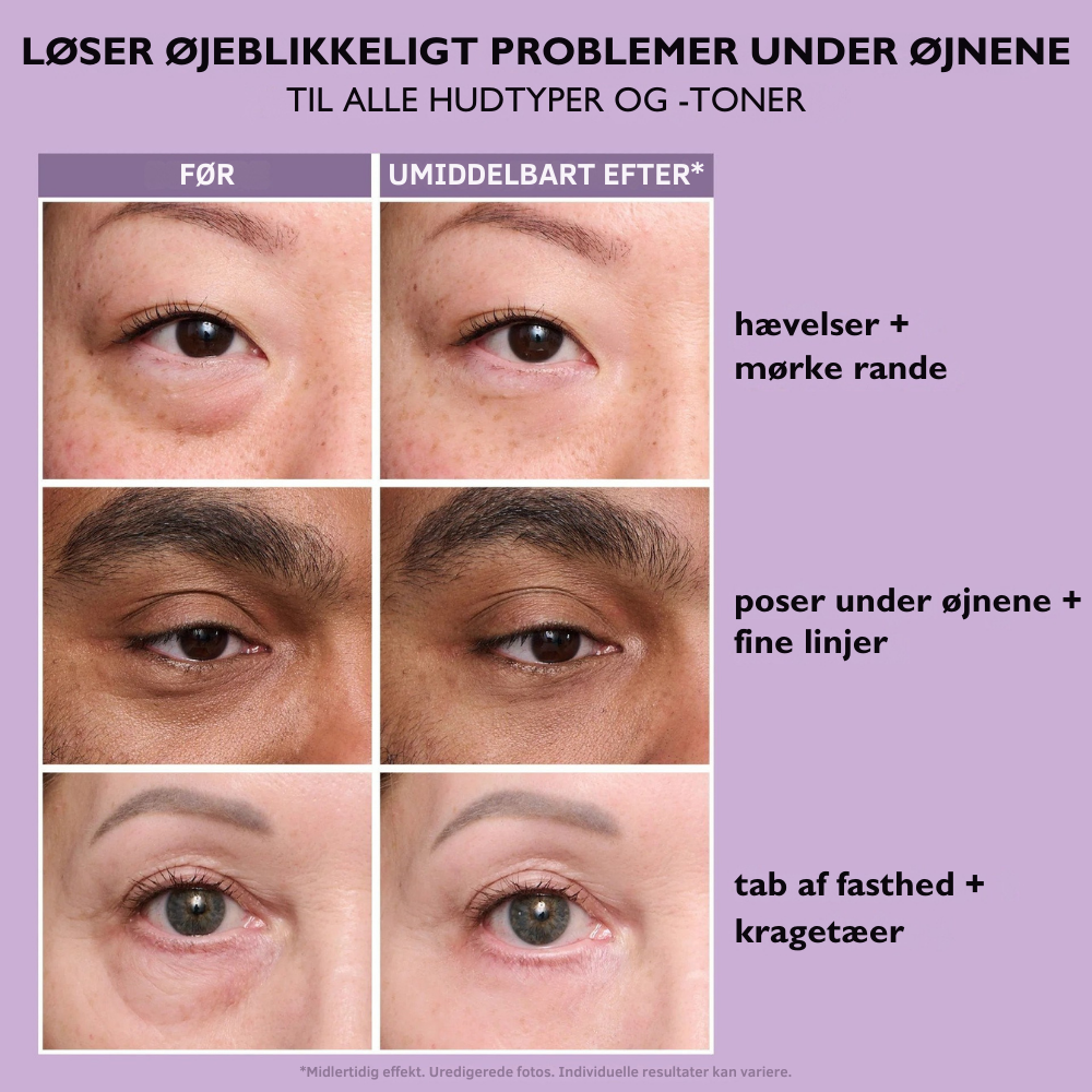 EternaLift™ | Øjencremen der fjerner poser under øjnene øjeblikkeligt og får dig til at se 10 år yngre ud