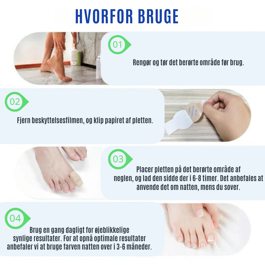 NailRepair™ | Plaster til neglesvamp