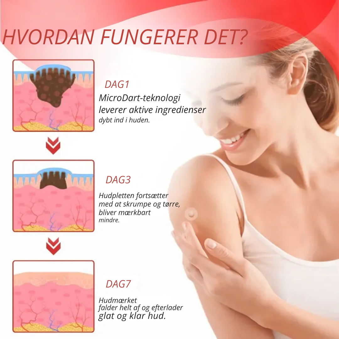 DermaPatch™ | Fjern hængende vorter smertefrit – uden ar, uden snit, uden stress!