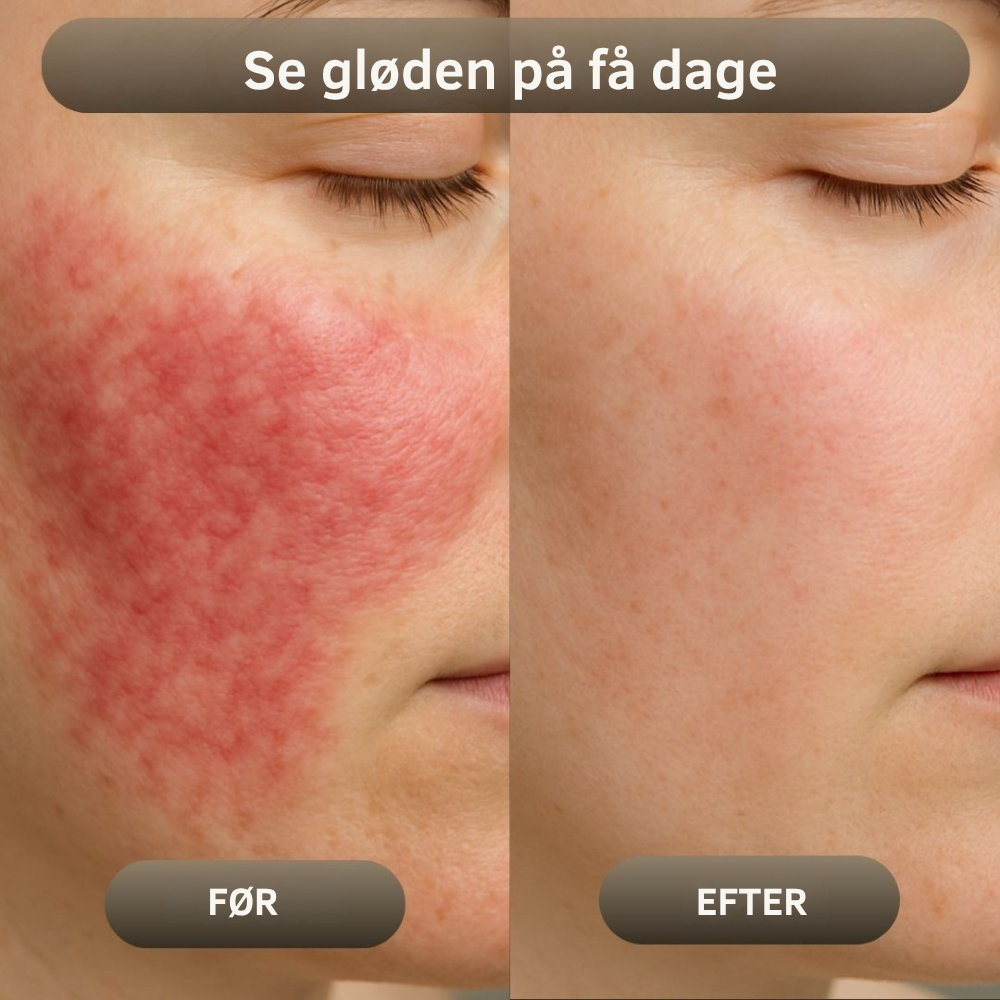 NaturaBalm™ | Den naturlige fugt, din hud har længtes efter