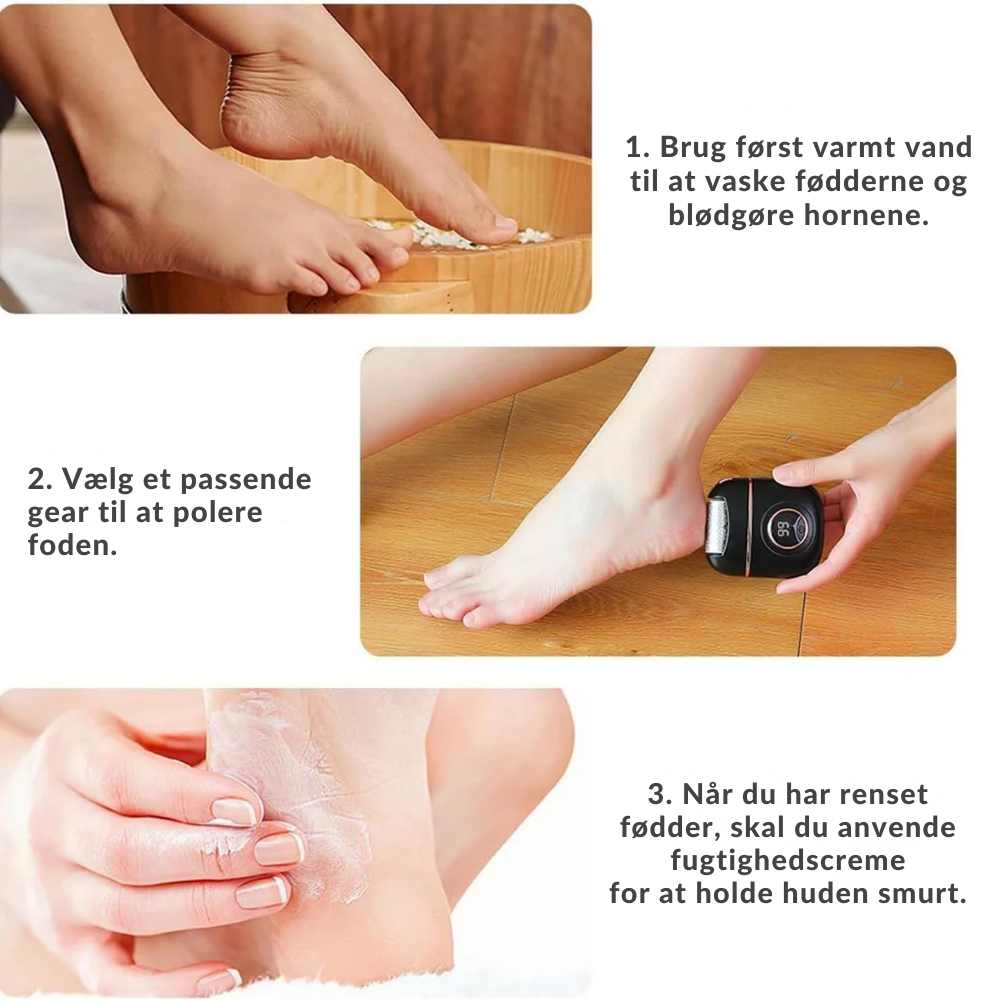 SilkSole™ | Elektrisk fjernelse af hård hud til glatte fødder