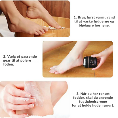 SilkSole™ | Elektrisk fjernelse af hård hud til glatte fødder