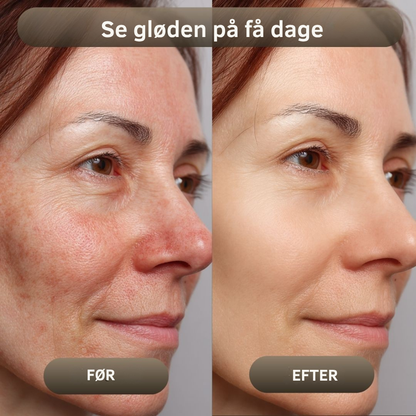 NaturaBalm™ | Den naturlige fugt, din hud har længtes efter