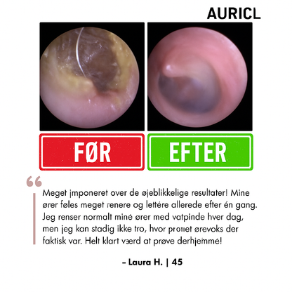 AuriClean™ | Elektrisk Ørevoksfjerningssæt