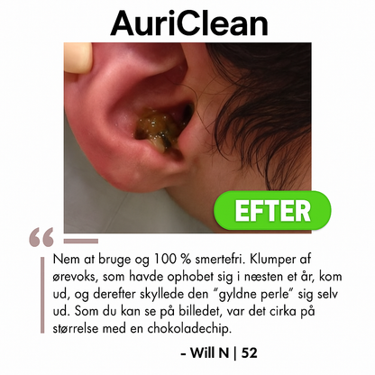 AuriClean™ | Elektrisk Ørevoksfjerningssæt