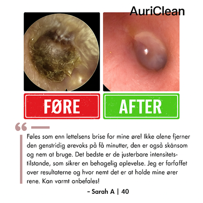 AuriClean™ | Elektrisk Ørevoksfjerningssæt