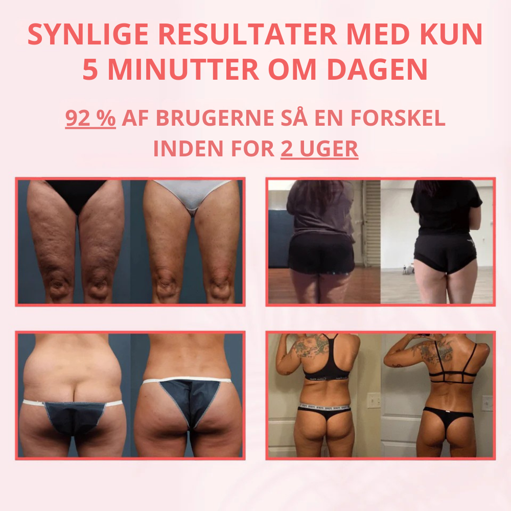 CelluSculpt™ | 4-i-1 -massageapparat med cupping, infrarød og varme – reducerer cellulite og strækmærker synligt