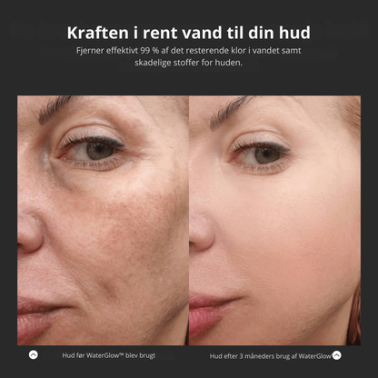 WaterGlow™ – Fordi din hud fortjener det bedste