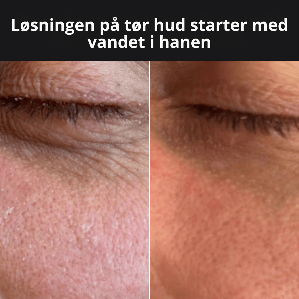 WaterGlow™ – Fordi din hud fortjener det bedste