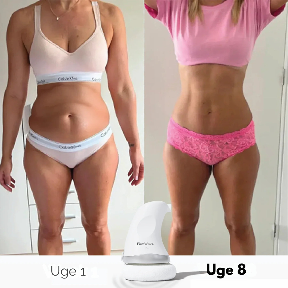 FirmWave™ | Genopdag følelsen af en fast og tonet krop