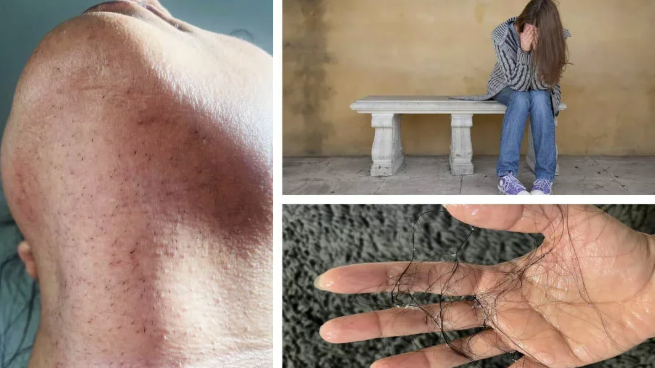 EpiLisse™ | Skånsom hårfjerningscreme til silkeblød hud – uden smerte eller rødme