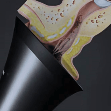 AuriClean™ | Elektrisk Ørevoksfjerningssæt