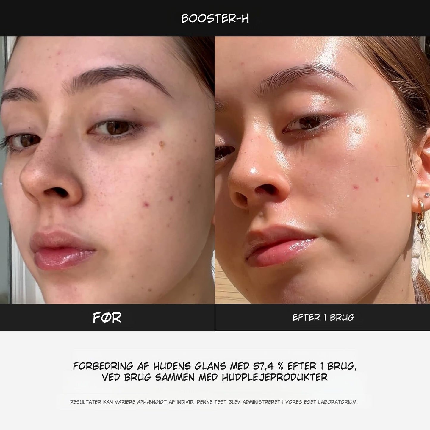 LumaBooster™ | Avanceret Hudpleje til Bedre Hudstruktur og Aknebehandling