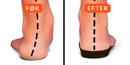 FeetRelief™ | Slip for fodsmerter – Uden dyre behandlinger eller unødvendige lægebesøg