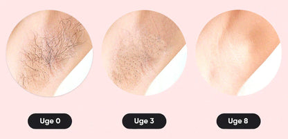 SmoothTouch™ IPL | Permanent hårfjerning – skånsom teknologi til glat hud hele året